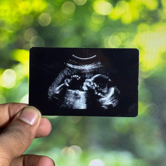 Baby scan wallet card